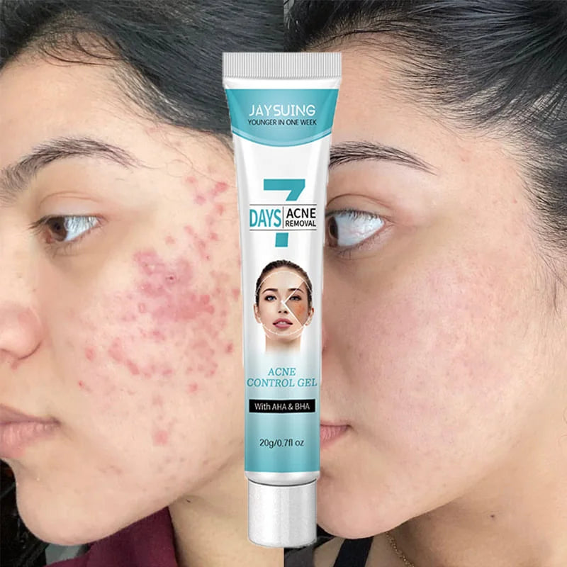 💙7 DAYS⭐⭐⭐⭐⭐ 2X1 Tratamiento en gel⚕️