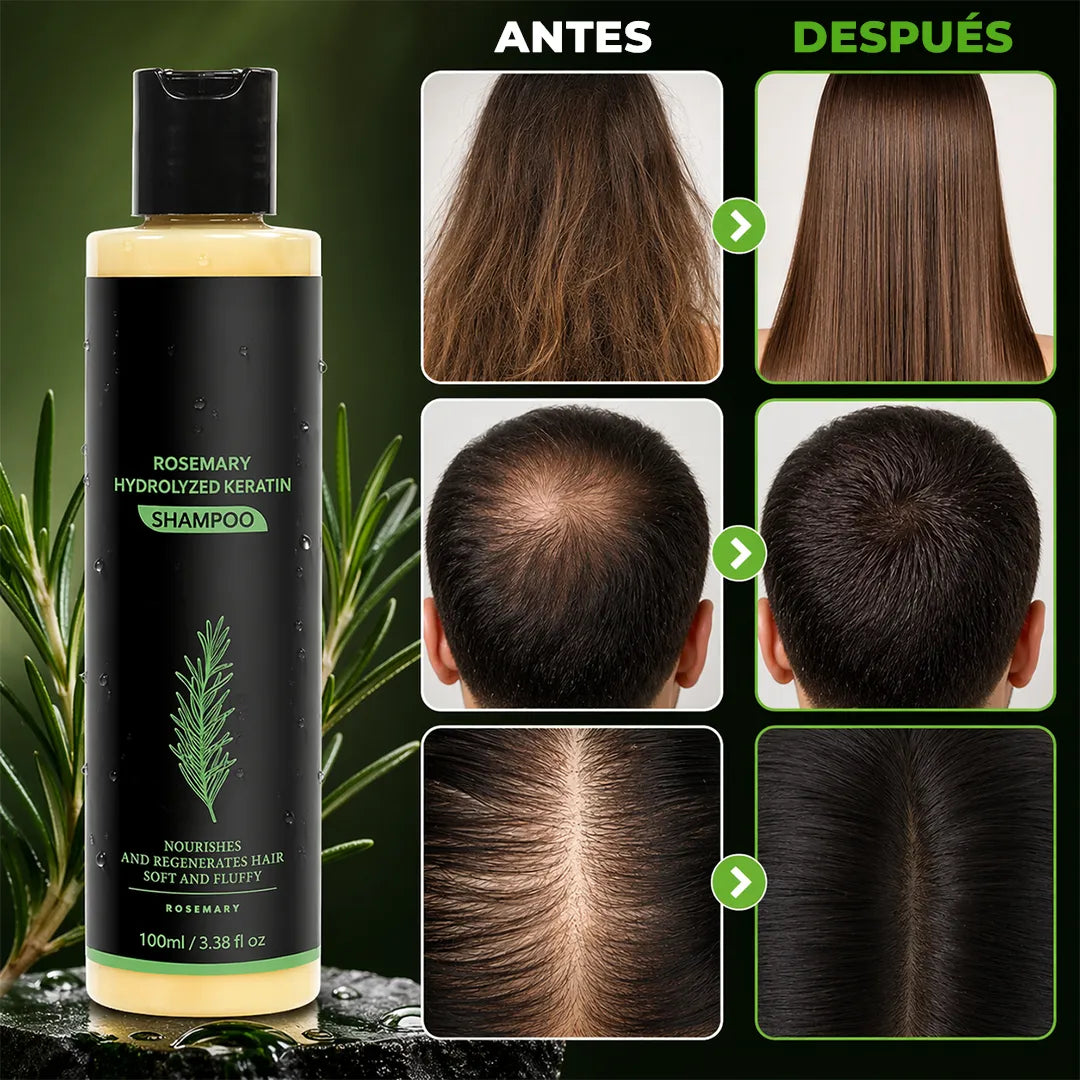 Shampoo estimulador para crecimiento del cabello